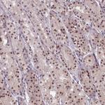 MYST2 Antibody in Immunohistochemistry (Paraffin) (IHC (P))