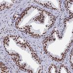 ZNF280A Polyclonal Antibody