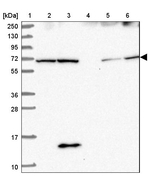 SDCCAG8 Antibody in Western Blot (WB)