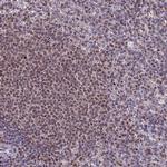 MIS12 Polyclonal Antibody