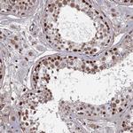 TAF13 Antibody in Immunohistochemistry (Paraffin) (IHC (P))