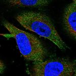 METTL13 Polyclonal Antibody