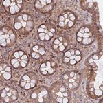 METTL13 Antibody in Immunohistochemistry (Paraffin) (IHC (P))