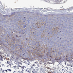 GPR113 Antibody in Immunohistochemistry (Paraffin) (IHC (P))