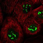 TDIF2 Polyclonal Antibody