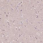 TDIF2 Antibody in Immunohistochemistry (Paraffin) (IHC (P))