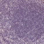 TDIF2 Antibody in Immunohistochemistry (Paraffin) (IHC (P))