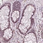 TDIF2 Antibody in Immunohistochemistry (Paraffin) (IHC (P))