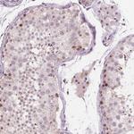 TDIF2 Antibody in Immunohistochemistry (Paraffin) (IHC (P))