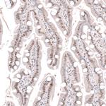 WDSOF1 Antibody in Immunohistochemistry (Paraffin) (IHC (P))