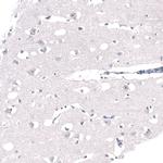 WDSOF1 Antibody in Immunohistochemistry (Paraffin) (IHC (P))