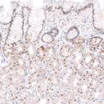 WDSOF1 Antibody in Immunohistochemistry (Paraffin) (IHC (P))
