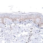 WDSOF1 Antibody in Immunohistochemistry (Paraffin) (IHC (P))