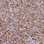 POMGNT1 Polyclonal Antibody