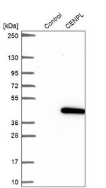 CENPL Antibody in Western Blot (WB)