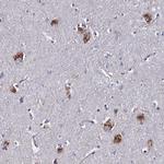 KIAA1324L Antibody in Immunohistochemistry (Paraffin) (IHC (P))