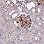 ETNPPL Isoform 1 Antibody in Immunohistochemistry (IHC)