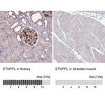 ETNPPL Isoform 1 Antibody