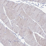 ETNPPL Isoform 1 Antibody in Immunohistochemistry (Paraffin) (IHC (P))