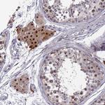 ZNF717 Antibody in Immunohistochemistry (Paraffin) (IHC (P))