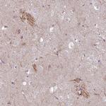 KVbeta1 (KCNAB1) Polyclonal Antibody