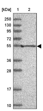 KVbeta1 (KCNAB1) Antibody in Western Blot (WB)
