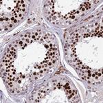 OTUD7A Antibody in Immunohistochemistry (Paraffin) (IHC (P))
