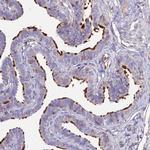 NME5 Antibody in Immunohistochemistry (Paraffin) (IHC (P))