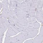 NME5 Antibody in Immunohistochemistry (Paraffin) (IHC (P))