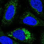 NDUFC1 Polyclonal Antibody