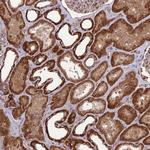 NDUFC1 Antibody in Immunohistochemistry (Paraffin) (IHC (P))