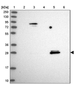 SPIN4 Antibody in Western Blot (WB)