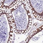 TRAM1L1 Antibody in Immunohistochemistry (Paraffin) (IHC (P))