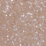 TMEM161B Polyclonal Antibody