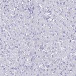 TMEM161B Antibody in Immunohistochemistry (Paraffin) (IHC (P))