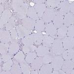 TMEM161B Antibody in Immunohistochemistry (Paraffin) (IHC (P))