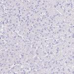 SMR3A Antibody in Immunohistochemistry (Paraffin) (IHC (P))