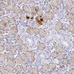 SMR3A Antibody in Immunohistochemistry (IHC)