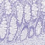 SMR3A Antibody in Immunohistochemistry (IHC)