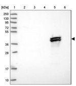 BHMT2 Antibody in Western Blot (WB)