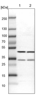 BHMT2 Antibody in Western Blot (WB)