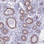 RASGEF1B Polyclonal Antibody