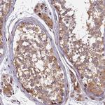 RAB28 Polyclonal Antibody