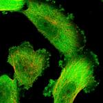 HINT1 Polyclonal Antibody