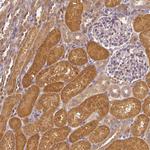 ADH5 Antibody in Immunohistochemistry (Paraffin) (IHC (P))