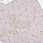 ADH5 Antibody in Immunohistochemistry (Paraffin) (IHC (P))