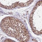 CDNF Polyclonal Antibody