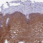 C6orf132 Antibody in Immunohistochemistry (IHC)
