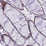 C6orf132 Antibody in Immunohistochemistry (IHC)