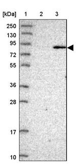 BBS7 Antibody in Western Blot (WB)